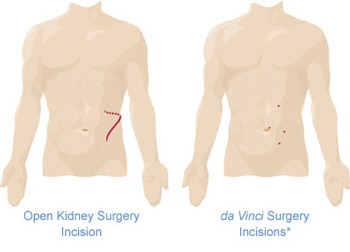 Urology